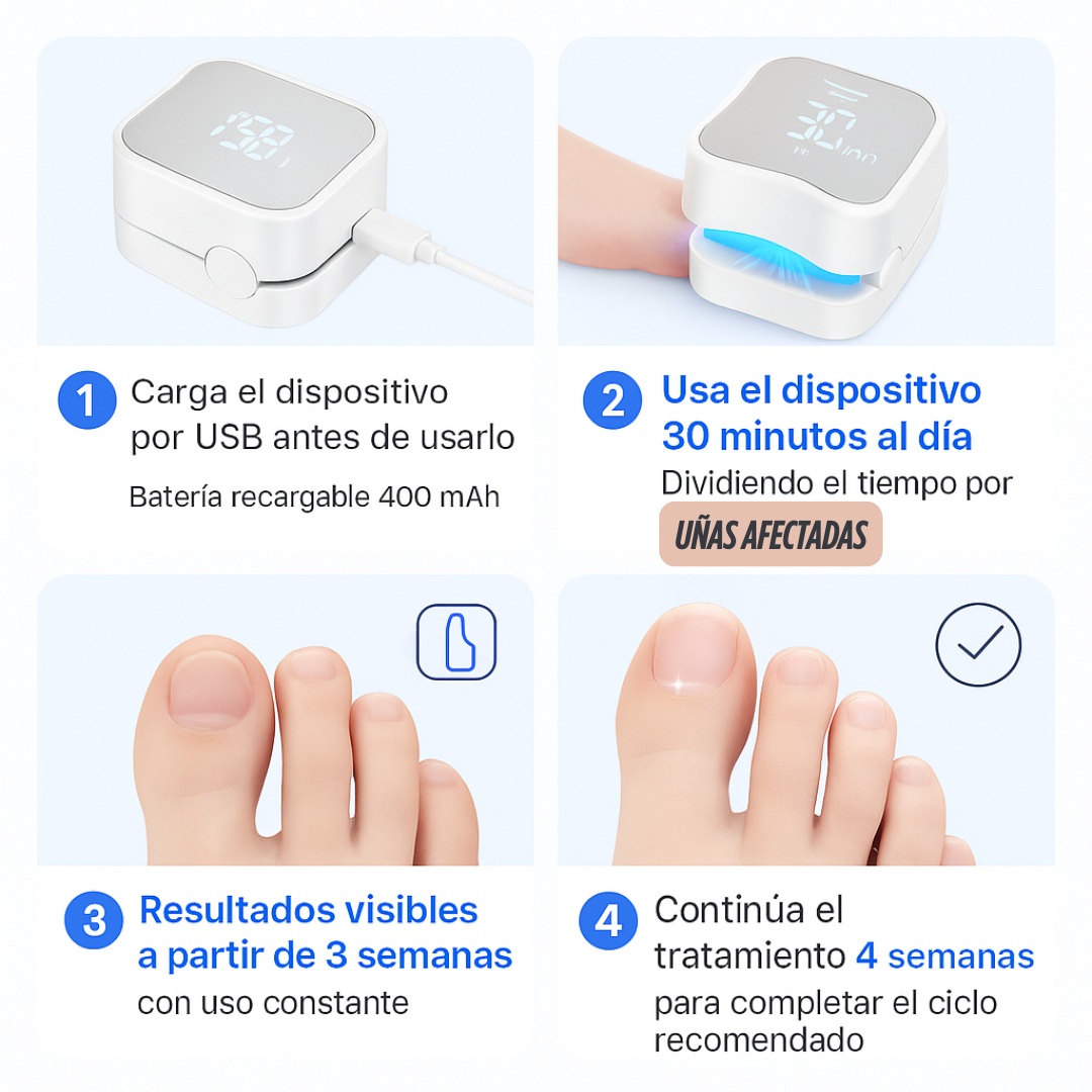 LÁSER QUITA HONGOS