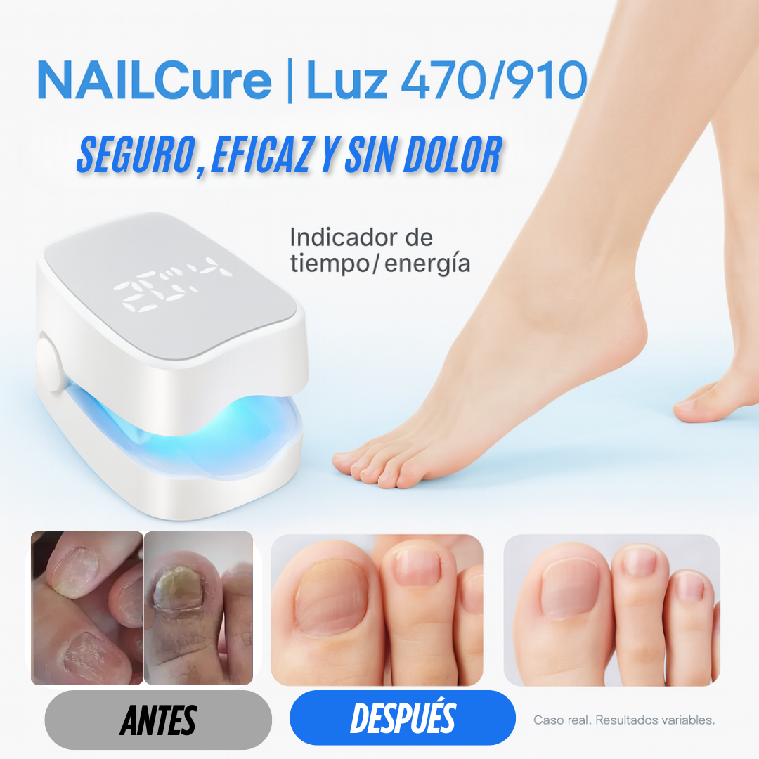 LÁSER QUITA HONGOS